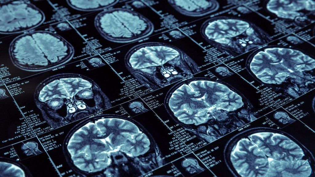 Ľavostranný mozog vs. Ľudia s pravým mozgom sú úplný mýtus, tvrdí veda