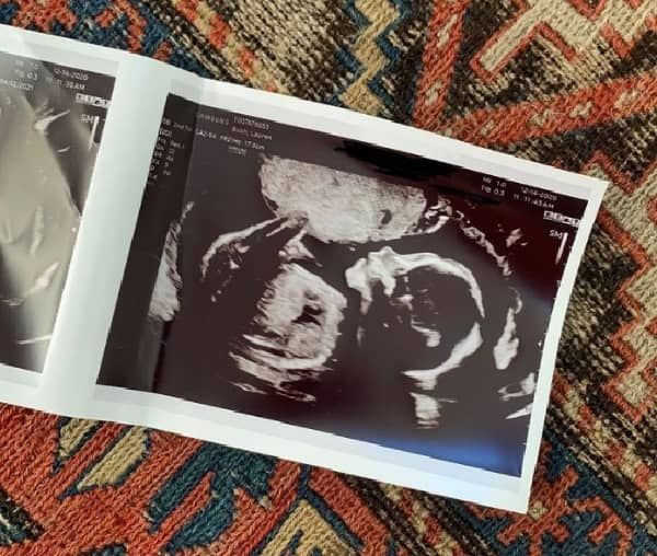 Lauren Bush forventer tredje barn med ektemannen David Lauren! Alt fra forslaget, ekteskap til barn